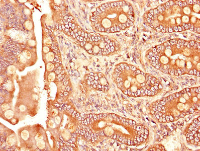 IHC image of CSB-PA023451LA01HU diluted at 1:1200 and staining in paraffin-embedded human small intestine tissue performed on a Leica BondTM system. After dewaxing and hydration, antigen retrieval was mediated by high pressure in a citrate buffer (pH 6.0). Section was blocked with 10% normal goat serum 30min at RT. Then primary antibody (1% BSA) was incubated at 4°C overnight. The primary is detected by a biotinylated secondary antibody and visualized using an HRP conjugated SP system.