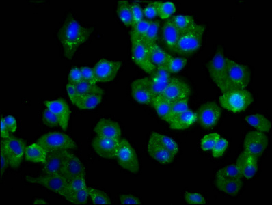 Immunofluorescence staining of HepG2 cells with CSB-PA023702LA01HU at 1:66, counter-stained with DAPI. The cells were fixed in 4% formaldehyde, permeabilized using 0.2% Triton X-100 and blocked in 10% normal Goat Serum. The cells were then incubated with the antibody overnight at 4°C. The secondary antibody was Alexa Fluor 488-congugated AffiniPure Goat Anti-Rabbit IgG(H+L). Immunofluorescence staining of HepG2 cells with CSB-PA023702LA01HU at 1:66, counter-stained with DAPI. The cells were fixed in 4% formaldehyde, permeabilized using 0.2% Triton X-100 and blocked in 10% normal Goat Serum. The cells were then incubated with the antibody overnight at 4°C. The secondary antibody was Alexa Fluor 488-congugated AffiniPure Goat Anti-Rabbit IgG(H+L).
