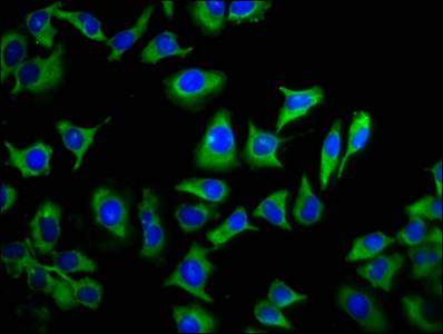 Immunofluorescence staining of A549 cells with CSB-PA023892LA01HU at 1:133, counter-stained with DAPI. The cells were fixed in 4% formaldehyde, permeabilized using 0.2% Triton X-100 and blocked in 10% normal Goat Serum. The cells were then incubated with the antibody overnight at 4°C. The secondary antibody was Alexa Fluor 488-congugated AffiniPure Goat Anti-Rabbit IgG(H+L). Immunofluorescence staining of A549 cells with CSB-PA023892LA01HU at 1:133, counter-stained with DAPI. The cells were fixed in 4% formaldehyde, permeabilized using 0.2% Triton X-100 and blocked in 10% normal Goat Serum. The cells were then incubated with the antibody overnight at 4°C. The secondary antibody was Alexa Fluor 488-congugated AffiniPure Goat Anti-Rabbit IgG(H+L).