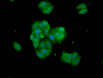 Immunofluorescence staining of HepG2 cells with CSB-PA024004LA01HU at 1:133, counter-stained with DAPI. The cells were fixed in 4% formaldehyde, permeabilized using 0.2% Triton X-100 and blocked in 10% normal Goat Serum. The cells were then incubated with the antibody overnight at 4°C. The secondary antibody was Alexa Fluor 488-congugated AffiniPure Goat Anti-Rabbit IgG(H+L).