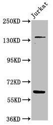Western Blot Positive WB detected in: Jurkat whole cell lysate All lanes: TNKS antibody at 4.8microg/ml Secondary Goat polyclonal to rabbit IgG at 1/50000 dilution Predicted band size: 143, 68 kDa Observed band size: 143, 68 kDa