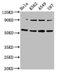 Western Blot Positive WB detected in: Hela whole cell lysate, K562 whole cell lysate, A549 whole cell lysate, U87 whole cell lysate All lanes: TOX antibody at 5.2microg/ml Secondary Goat polyclonal to rabbit IgG at 1/50000 dilution Predicted band size: 58 kDa Observed band size: 58 kDa
