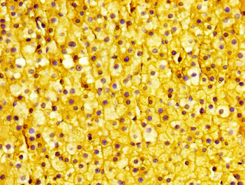IHC image of CSB-PA024113LA01HU diluted at 1:400 and staining in paraffin-embedded human adrenal gland tissue performed on a Leica BondTM system. After dewaxing and hydration, antigen retrieval was mediated by high pressure in a citrate buffer (pH 6.0). Section was blocked with 10% normal goat serum 30min at RT. Then primary antibody (1% BSA) was incubated at 4°C overnight. The primary is detected by a biotinylated secondary antibody and visualized using an HRP conjugated SP system. IHC image of CSB-PA024113LA01HU diluted at 1:400 and staining in paraffin-embedded human adrenal gland tissue performed on a Leica BondTM system. After dewaxing and hydration, antigen retrieval was mediated by high pressure in a citrate buffer (pH 6.0). Section was blocked with 10% normal goat serum 30min at RT. Then primary antibody (1% BSA) was incubated at 4°C overnight. The primary is detected by a biotinylated secondary antibody and visualized using an HRP conjugated SP system.