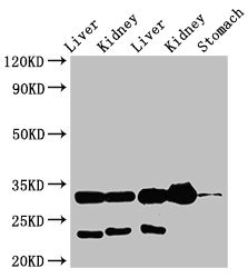 Western Blot Positive WB detected in: Rat liver tissue, Rat kidney tissue, Mouse liver tissue, Mouse kidney tissue, Mouse stomach tissue All lanes: TPSB2 antibody at 3microg/ml Secondary Goat polyclonal to rabbit IgG at 1/50000 dilution Predicted band size: 31 kDa Observed band size: 31 kDa