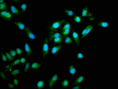 Immunofluorescence(IF) - TRAF6 Antibody