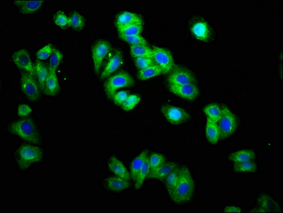Immunofluorescence staining of HepG2 cells with CSB-PA024441LA01HU at 1:166, counter-stained with DAPI. The cells were fixed in 4% formaldehyde, permeabilized using 0.2% Triton X-100 and blocked in 10% normal Goat Serum. The cells were then incubated with the antibody overnight at 4°C. The secondary antibody was Alexa Fluor 488-congugated AffiniPure Goat Anti-Rabbit IgG(H+L). Immunofluorescence staining of HepG2 cells with CSB-PA024441LA01HU at 1:166, counter-stained with DAPI. The cells were fixed in 4% formaldehyde, permeabilized using 0.2% Triton X-100 and blocked in 10% normal Goat Serum. The cells were then incubated with the antibody overnight at 4°C. The secondary antibody was Alexa Fluor 488-congugated AffiniPure Goat Anti-Rabbit IgG(H+L).