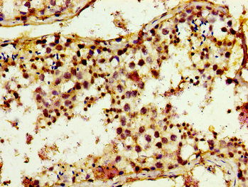 Immunohistochemistry of paraffin-embedded human testis tissue using CSB-PA024467LA01HU at dilution of 1:100 Immunohistochemistry of paraffin-embedded human testis tissue using CSB-PA024467LA01HU at dilution of 1:100