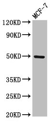 Western Blot Positive WB detected in: MCF-7 whole cell lysate All lanes: TWIST1 antibody at 3microg/ml Secondary Goat polyclonal to rabbit IgG at 1/50000 dilution Predicted band size: 21 kDa Observed band size: 50 kDa Western Blot Positive WB detected in: MCF-7 whole cell lysate All lanes: TWIST1 antibody at 3microg/ml Secondary Goat polyclonal to rabbit IgG at 1/50000 dilution Predicted band size: 21 kDa Observed band size: 50 kDa