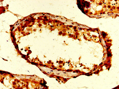 IHC image of CSB-PA025416LA01HU diluted at 1:200 and staining in paraffin-embedded human testis tissue performed on a Leica BondTM system. After dewaxing and hydration, antigen retrieval was mediated by high pressure in a citrate buffer (pH 6.0). Section was blocked with 10% normal goat serum 30min at RT. Then primary antibody (1% BSA) was incubated at 4°C overnight. The primary is detected by a biotinylated secondary antibody and visualized using an HRP conjugated SP system. IHC image of CSB-PA025416LA01HU diluted at 1:200 and staining in paraffin-embedded human testis tissue performed on a Leica BondTM system. After dewaxing and hydration, antigen retrieval was mediated by high pressure in a citrate buffer (pH 6.0). Section was blocked with 10% normal goat serum 30min at RT. Then primary antibody (1% BSA) was incubated at 4°C overnight. The primary is detected by a biotinylated secondary antibody and visualized using an HRP conjugated SP system.