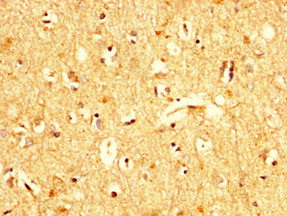 IHC image of CSB-PA025416LA01HU diluted at 1:200 and staining in paraffin-embedded human brain tissue performed on a Leica BondTM system. After dewaxing and hydration, antigen retrieval was mediated by high pressure in a citrate buffer (pH 6.0). Section was blocked with 10% normal goat serum 30min at RT. Then primary antibody (1% BSA) was incubated at 4°C overnight. The primary is detected by a biotinylated secondary antibody and visualized using an HRP conjugated SP system.