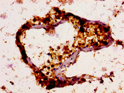 IHC image of CSB-PA025470LA01HU diluted at 1:200 and staining in paraffin-embedded human testis tissue performed on a Leica BondTM system. After dewaxing and hydration, antigen retrieval was mediated by high pressure in a citrate buffer (pH 6.0). Section was blocked with 10% normal goat serum 30min at RT. Then primary antibody (1% BSA) was incubated at 4°C overnight. The primary is detected by a biotinylated secondary antibody and visualized using an HRP conjugated SP system. IHC image of CSB-PA025470LA01HU diluted at 1:200 and staining in paraffin-embedded human testis tissue performed on a Leica BondTM system. After dewaxing and hydration, antigen retrieval was mediated by high pressure in a citrate buffer (pH 6.0). Section was blocked with 10% normal goat serum 30min at RT. Then primary antibody (1% BSA) was incubated at 4°C overnight. The primary is detected by a biotinylated secondary antibody and visualized using an HRP conjugated SP system.
