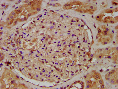 IHC image of CSB-PA025579LA01HU diluted at 1:200 and staining in paraffin-embedded human kidney tissue performed on a Leica BondTM system. After dewaxing and hydration, antigen retrieval was mediated by high pressure in a citrate buffer (pH 6.0). Section was blocked with 10% normal goat serum 30min at RT. Then primary antibody (1% BSA) was incubated at 4°C overnight. The primary is detected by a biotinylated secondary antibody and visualized using an HRP conjugated SP system. IHC image of CSB-PA025579LA01HU diluted at 1:200 and staining in paraffin-embedded human kidney tissue performed on a Leica BondTM system. After dewaxing and hydration, antigen retrieval was mediated by high pressure in a citrate buffer (pH 6.0). Section was blocked with 10% normal goat serum 30min at RT. Then primary antibody (1% BSA) was incubated at 4°C overnight. The primary is detected by a biotinylated secondary antibody and visualized using an HRP conjugated SP system.