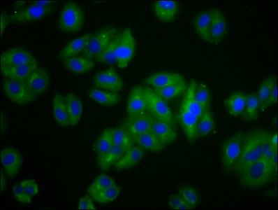 Immunofluorescence staining of HepG2 cells with CSB-PA025865LA01HU at 1:100, counter-stained with DAPI. The cells were fixed in 4% formaldehyde, permeabilized using 0.2% Triton X-100 and blocked in 10% normal Goat Serum. The cells were then incubated with the antibody overnight at 4°C. The secondary antibody was Alexa Fluor 488-congugated AffiniPure Goat Anti-Rabbit IgG(H+L).