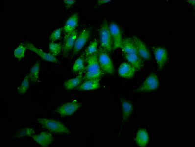 Immunofluorescence staining of Hela cells with CSB-PA026107LA01HU at 1:133, counter-stained with DAPI. The cells were fixed in 4% formaldehyde, permeabilized using 0.2% Triton X-100 and blocked in 10% normal Goat Serum. The cells were then incubated with the antibody overnight at 4°C. The secondary antibody was Alexa Fluor 488-congugated AffiniPure Goat Anti-Rabbit IgG(H+L).