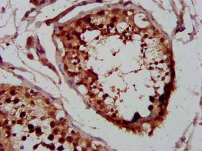 IHC image of CSB-PA026107LA01HU diluted at 1:400 and staining in paraffin-embedded human testis tissue performed on a Leica BondTM system. After dewaxing and hydration, antigen retrieval was mediated by high pressure in a citrate buffer (pH 6.0). Section was blocked with 10% normal goat serum 30min at RT. Then primary antibody (1% BSA) was incubated at 4°C overnight. The primary is detected by a biotinylated secondary antibody and visualized using an HRP conjugated SP system. IHC image of CSB-PA026107LA01HU diluted at 1:400 and staining in paraffin-embedded human testis tissue performed on a Leica BondTM system. After dewaxing and hydration, antigen retrieval was mediated by high pressure in a citrate buffer (pH 6.0). Section was blocked with 10% normal goat serum 30min at RT. Then primary antibody (1% BSA) was incubated at 4°C overnight. The primary is detected by a biotinylated secondary antibody and visualized using an HRP conjugated SP system.