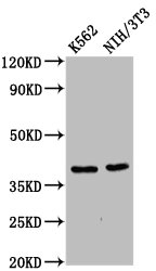 Western Blot Positive WB detected in: K562 whole cell lysate, NIH/3T3 whole cell lysate All lanes: ZNF367 antibody at 6microg/ml Secondary Goat polyclonal to rabbit IgG at 1/50000 dilution Predicted band size: 39, 33 kDa Observed band size: 39 kDa Western Blot Positive WB detected in: K562 whole cell lysate, NIH/3T3 whole cell lysate All lanes: ZNF367 antibody at 6microg/ml Secondary Goat polyclonal to rabbit IgG at 1/50000 dilution Predicted band size: 39, 33 kDa Observed band size: 39 kDa