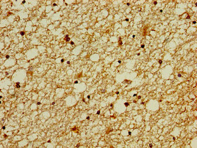 Immunohistochemistry of paraffin-embedded human brain tissue using CSB-PA026785LA01HU at dilution of 1:100