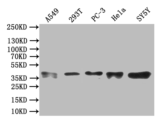 Western Blot Positive WB detected in: A549 whole cell lysate All lanes: ZNF488 antibody at 3.4microg/ml Secondary Goat polyclonal to rabbit IgG at 1/50000 dilution Predicted band size: 37, 26 kDa Observed band size: 37 kDa