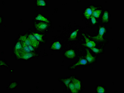 Immunofluorescence staining of MCF-7 cells with CSB-PA02775A0Rb at 1:330, counter-stained with DAPI. The cells were fixed in 4% formaldehyde, permeabilized using 0.2% Triton X-100 and blocked in 10% normal Goat Serum. The cells were then incubated with the antibody overnight at 4°C. The secondary antibody was Alexa Fluor 488-congugated AffiniPure Goat Anti-Rabbit IgG(H+L).