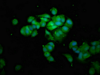 Immunofluorescence staining of MCF-7 cells with CSB-PA02939A0Rb at 1:100, counter-stained with DAPI. The cells were fixed in 4% formaldehyde, permeabilized using 0.2% Triton X-100 and blocked in 10% normal Goat Serum. The cells were then incubated with the antibody overnight at 4°C. The secondary antibody was Alexa Fluor 488-congugated AffiniPure Goat Anti-Rabbit IgG(H+L).