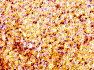 IHC image of CSB-PA02939A0Rb diluted at 1:100 and staining in paraffin-embedded human adrenal gland tissue performed on a Leica BondTM system. After dewaxing and hydration, antigen retrieval was mediated by high pressure in a citrate buffer (pH 6.0). Section was blocked with 10% normal goat serum 30min at RT. Then primary antibody (1% BSA) was incubated at 4°C overnight. The primary is detected by a biotinylated secondary antibody and visualized using an HRP conjugated SP system. IHC image of CSB-PA02939A0Rb diluted at 1:100 and staining in paraffin-embedded human adrenal gland tissue performed on a Leica BondTM system. After dewaxing and hydration, antigen retrieval was mediated by high pressure in a citrate buffer (pH 6.0). Section was blocked with 10% normal goat serum 30min at RT. Then primary antibody (1% BSA) was incubated at 4°C overnight. The primary is detected by a biotinylated secondary antibody and visualized using an HRP conjugated SP system.