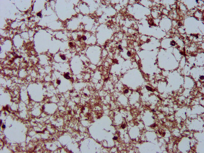 IHC image of CSB-PA05027A0Rb diluted at 1:200 and staining in paraffin-embedded human brain tissue performed on a Leica BondTM system. After dewaxing and hydration, antigen retrieval was mediated by high pressure in a citrate buffer (pH 6.0). Section was blocked with 10% normal goat serum 30min at RT. Then primary antibody (1% BSA) was incubated at 4°C overnight. The primary is detected by a biotinylated secondary antibody and visualized using an HRP conjugated SP system.