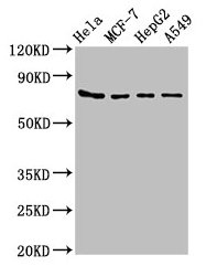 Western Blot Positive WB detected in: Hela whole cell lysate, MCF-7 whole cell lysate, HepG2 whole cell lysate, A549 whole cell lysate All lanes: HSPA5 antibody at 4microg/ml Secondary Goat polyclonal to rabbit IgG at 1/50000 dilution Predicted band size: 73 kDa Observed band size: 73 kDa Western Blot Positive WB detected in: Hela whole cell lysate, MCF-7 whole cell lysate, HepG2 whole cell lysate, A549 whole cell lysate All lanes: HSPA5 antibody at 4microg/ml Secondary Goat polyclonal to rabbit IgG at 1/50000 dilution Predicted band size: 73 kDa Observed band size: 73 kDa