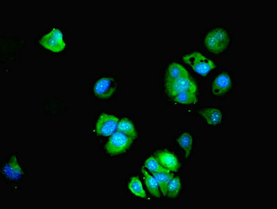 Immunofluorescent analysis of MCF-7 cells using CSB-PA05095A0Rb at dilution of 1:100 and Alexa Fluor 488-congugated AffiniPure Goat Anti-Rabbit IgG(H+L)