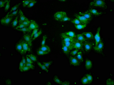 Immunofluorescence(IF) - GABARAP Antibody