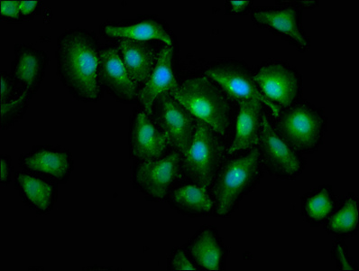 Immunofluorescence(IF) - CASP3 Antibody