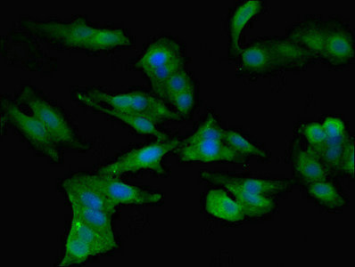 Immunofluorescence(IF) - CCL2 Antibody