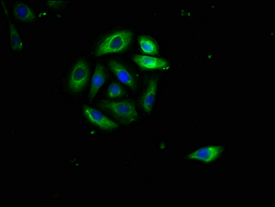 Immunofluorescence(IF) - FAS Antibody