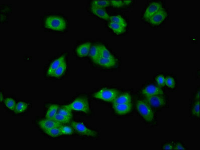 Immunofluorescence(IF) - TFRC Antibody