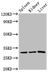 Western Blot Positive WB detected in: Rat spleen tissue, Rat kidney tissue, Rat liver tissue All lanes: CD27 antibody at 3.2microg/ml Secondary Goat polyclonal to rabbit IgG at 1/50000 dilution Predicted band size: 30 kDa Observed band size: 30 kDa