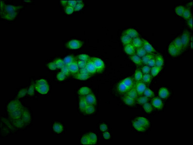 Immunofluorescence staining of PC-3 cells with CSB-PA12259A0Rb at 1:100, counter-stained with DAPI. The cells were fixed in 4% formaldehyde, permeabilized using 0.2% Triton X-100 and blocked in 10% normal Goat Serum. The cells were then incubated with the antibody overnight at 4°C. The secondary antibody was Alexa Fluor 488-congugated AffiniPure Goat Anti-Rabbit IgG(H+L).