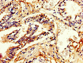 Immunohistochemistry of paraffin-embedded human lung tissue using CSB-PA21029A0Rb at dilution of 1:100