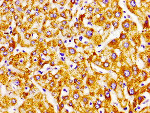 Immunohistochemistry of paraffin-embedded human liver tissue using CSB-PA527983LA01HU at dilution of 1:100