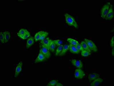 Immunofluorescence(IF) - DSC3 Antibody