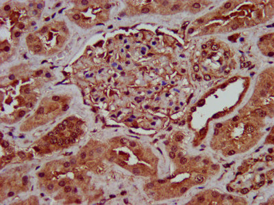 IHC image of CSB-PA617926LA01HU diluted at 1:400 and staining in paraffin-embedded human kidney tissue performed on a Leica BondTM system. After dewaxing and hydration, antigen retrieval was mediated by high pressure in a citrate buffer (pH 6.0). Section was blocked with 10% normal goat serum 30min at RT. Then primary antibody (1% BSA) was incubated at 4°C overnight. The primary is detected by a biotinylated secondary antibody and visualized using an HRP conjugated SP system.