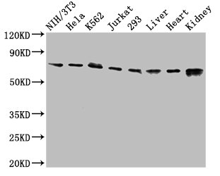 Western Blot Positive WB detected in: NIH/3T3 whole cell lysate, Hela whole cell lysate, K562 whole cell lysate, Jurkat whole cell lysate, 293 whole cell lysate, Rat liver tissue, Mouse heart tissue, Mouse kidney tissue All lanes: RIPK1 antibody at 3.2microg/ml Secondary Goat polyclonal to rabbit IgG at 1/50000 dilution Predicted band size: 76, 71 kDa Observed band size: 76 kDa Western Blot Positive WB detected in: NIH/3T3 whole cell lysate, Hela whole cell lysate, K562 whole cell lysate, Jurkat whole cell lysate, 293 whole cell lysate, Rat liver tissue, Mouse heart tissue, Mouse kidney tissue All lanes: RIPK1 antibody at 3.2microg/ml Secondary Goat polyclonal to rabbit IgG at 1/50000 dilution Predicted band size: 76, 71 kDa Observed band size: 76 kDa