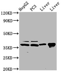 Western Blot Positive WB detected in: HepG2 whole cell lysate, PC-3 whole cell lysate, Rat liver tissue, Mouse liver tissue All lanes: E2F5 antibody at 5microg/ml Secondary Goat polyclonal to rabbit IgG at 1/50000 dilution Predicted band size: 38, 21 kDa Observed band size: 38 kDa Western Blot Positive WB detected in: HepG2 whole cell lysate, PC-3 whole cell lysate, Rat liver tissue, Mouse liver tissue All lanes: E2F5 antibody at 5microg/ml Secondary Goat polyclonal to rabbit IgG at 1/50000 dilution Predicted band size: 38, 21 kDa Observed band size: 38 kDa