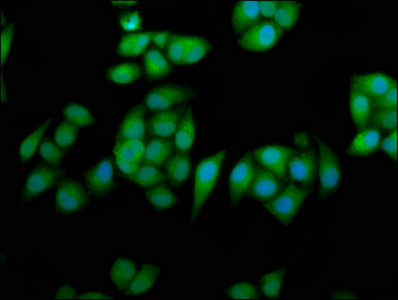 Immunofluorescence staining of Hela cells with CSB-PA624103LA01HU at 1:233, counter-stained with DAPI. The cells were fixed in 4% formaldehyde, permeabilized using 0.2% Triton X-100 and blocked in 10% normal Goat Serum. The cells were then incubated with the antibody overnight at 4°C. The secondary antibody was Alexa Fluor 488-congugated AffiniPure Goat Anti-Rabbit IgG(H+L).
