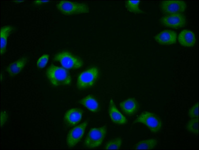 CSB-PA642654LA01HU