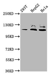 Western Blot Positive WB detected in: 293T whole cell lysate, HepG2 whole cell lysate, Hela whole cell lysate All lanes: MAP3K21 antibody at 3.3microg/ml Secondary Goat polyclonal to rabbit IgG at 1/50000 dilution Predicted band size: 114, 64, 53 kDa Observed band size: 114 kDa