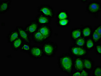 Immunofluorescence(IF) - LRRK2 Antibody