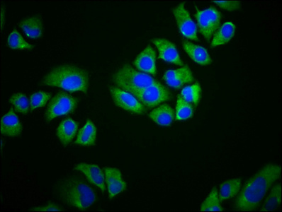 Immunofluorescence staining of Hela cells with CSB-PA754405LA01HU at 1:166, counter-stained with DAPI. The cells were fixed in 4% formaldehyde, permeabilized using 0.2% Triton X-100 and blocked in 10% normal Goat Serum. The cells were then incubated with the antibody overnight at 4°C. The secondary antibody was Alexa Fluor 488-congugated AffiniPure Goat Anti-Rabbit IgG(H+L).