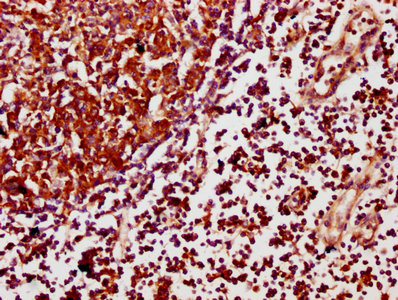 IHC image of CSB-PA754405LA01HU diluted at 1:500 and staining in paraffin-embedded human lymph node tissue performed on a Leica BondTM system. After dewaxing and hydration, antigen retrieval was mediated by high pressure in a citrate buffer (pH 6.0). Section was blocked with 10% normal goat serum 30min at RT. Then primary antibody (1% BSA) was incubated at 4°C overnight. The primary is detected by a biotinylated secondary antibody and visualized using an HRP conjugated SP system.