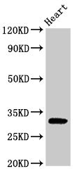 Western Blot Positive WB detected in: Rat heart tissue All lanes: PPP1R3B antibody at 2.5microg/ml Secondary Goat polyclonal to rabbit IgG at 1/50000 dilution Predicted band size: 33 kDa Observed band size: 33 kDa