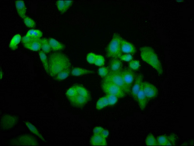 Immunofluorescence staining of PC-3 cells with CSB-PA773793LA01HU at 1:100, counter-stained with DAPI. The cells were fixed in 4% formaldehyde, permeabilized using 0.2% Triton X-100 and blocked in 10% normal Goat Serum. The cells were then incubated with the antibody overnight at 4°C. The secondary antibody was Alexa Fluor 488-congugated AffiniPure Goat Anti-Rabbit IgG(H+L).