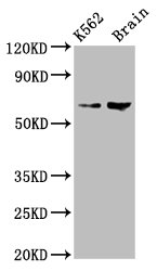 Western Blot Positive WB detected in: K562 whole cell lysate, Rat brain tissue All lanes: BRAP antibody at 7.5microg/ml Secondary Goat polyclonal to rabbit IgG at 1/50000 dilution Predicted band size: 68, 48 kDa Observed band size: 68 kDa